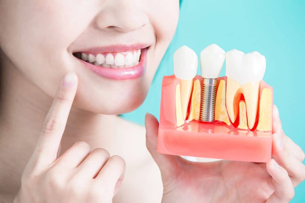 4 Myths About Dental