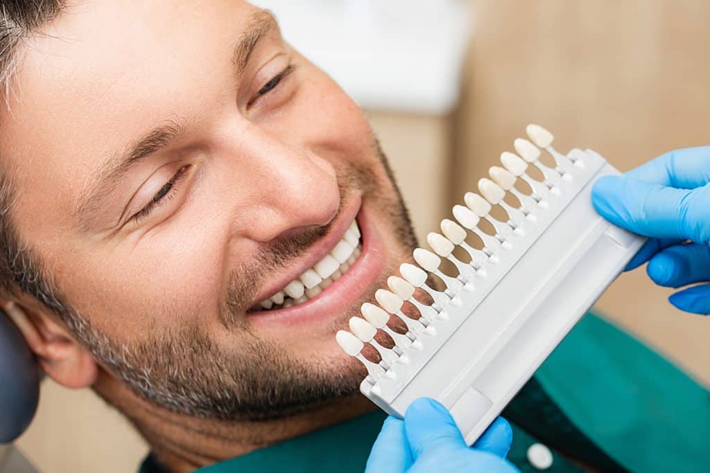 How to Choose the Right Shade of Veneers for a Natural Look